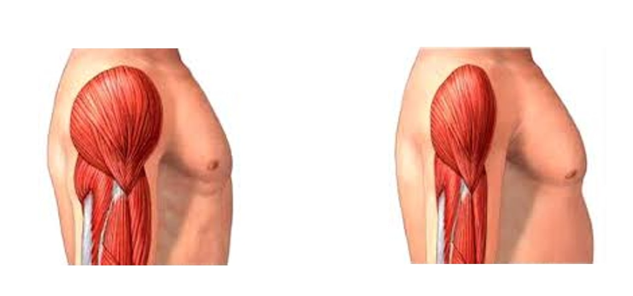 Vieillissement et perte de capacités musculaires